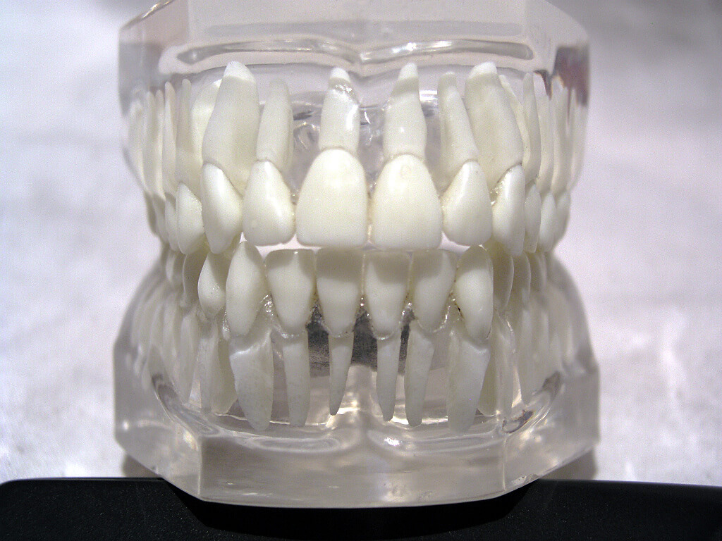 front-teeth