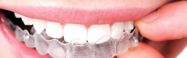 Does Invisalign® work as well as fixed braces?