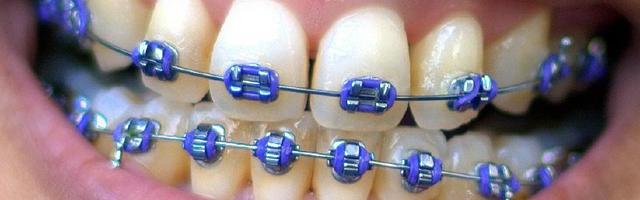 How To Pick the Perfect Orthodontist