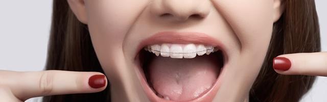 When To Start Orthodontic Treatment