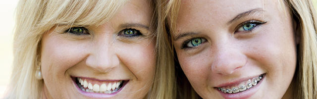 What To Expect After Braces Removal