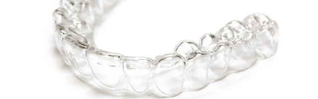 Lingual Braces Vs. Clear Aligners
