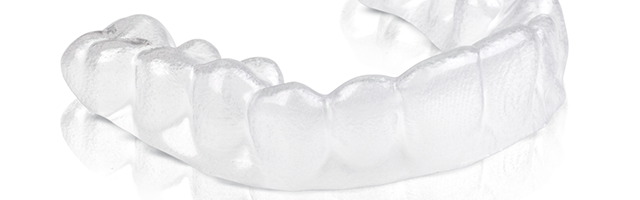 Aligners versus Fixed Braces