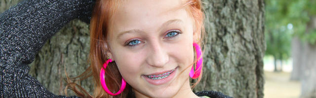 Braces for Teenagers
