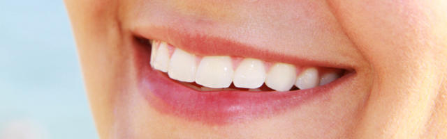 Tooth whitening at home?