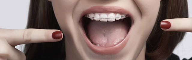 The Length of an Orthodontic Treatment