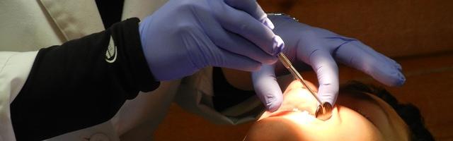 Mini Screws In Orthodontic Treatment