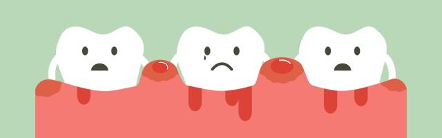 Bleeding Gums: How To Treat Them With Braces