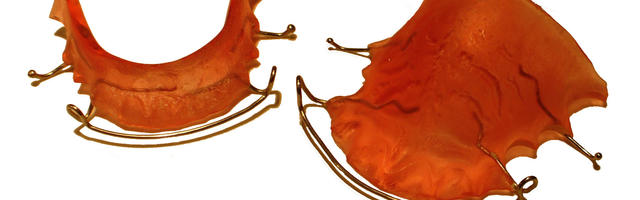 Removable Braces for Adult Orthodontics