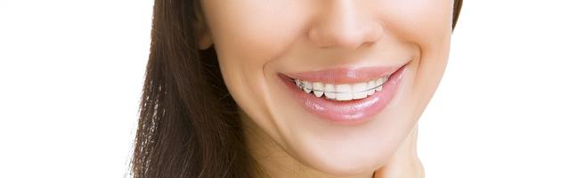 A Startling Statistic: 25% of Patients Don’t Wear Their Orthodontic Retainers As Directed