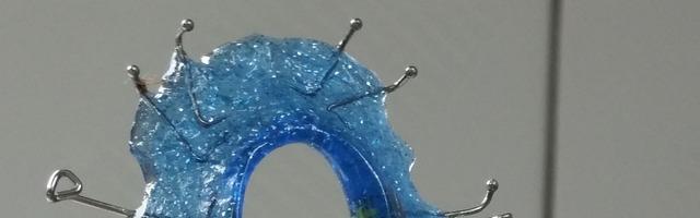 Teeth Retainers: Why Must You Wear Them?