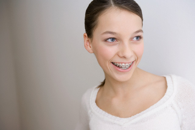Myth Braces Made Of Metal Are Magnetic Orthodontics In London
