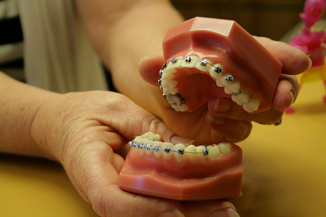 10 Things To Know Before Getting Braces Orthodontics In London
