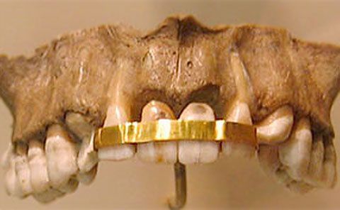 A Little History Of Orthodontics | Orthodontics in London
